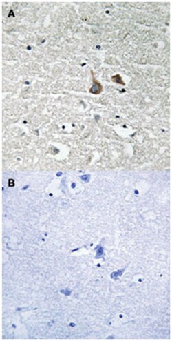 IRAK1 (phospho S376), Rabbit, Polyclonal Antibody, Abnova 100 &mu;L | Buy Online | Abnova | Fisher Scientific