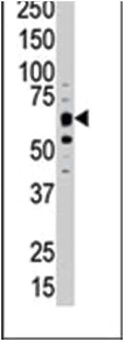 DYRK1B, Rabbit, Polyclonal Antibody, Abnova 400 &mu;L | Buy Online | Abnova Corporation | Fisher Scientific