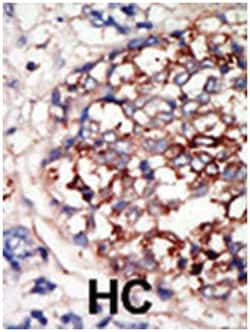 DYRK1B, Rabbit, Polyclonal Antibody, Abnova 400 &mu;L | Buy Online | Abnova Corporation | Fisher Scientific