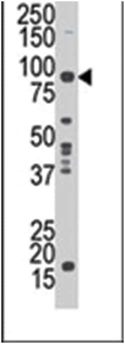 MAK, Rabbit, Polyclonal Antibody, Abnova 400 &mu;L | Buy Online | Abnova Corporation | Fisher Scientific