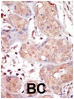 MAK, Rabbit, Polyclonal Antibody, Abnova 400 &mu;L | Buy Online | Abnova Corporation | Fisher Scientific