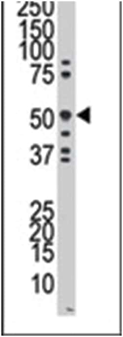 RAGE Rabbit anti-Human, Polyclonal Antibody, Abnova 400 &mu;L | Buy Online | Abnova Corporation | Fisher Scientific