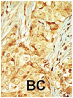 RAGE Rabbit anti-Human, Polyclonal Antibody, Abnova 400 &mu;L | Buy Online | Abnova Corporation | Fisher Scientific