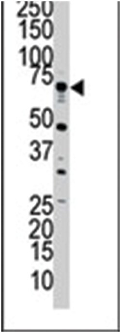 SRPK3, Rabbit, Polyclonal Antibody, Abnova 400 &mu;L | Buy Online | Abnova Corporation | Fisher Scientific