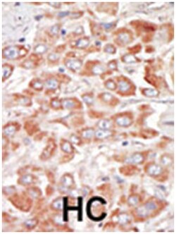 SRPK3, Rabbit, Polyclonal Antibody, Abnova 400 &mu;L | Buy Online | Abnova Corporation | Fisher Scientific