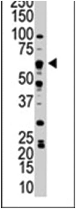 NLK, Rabbit, Polyclonal Antibody, Abnova 400 &mu;L | Buy Online | Abnova Corporation | Fisher Scientific
