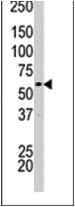 PCTK2, Rabbit, Polyclonal Antibody, Abnova 400&mu;L; Unlabeled:Anticuerpos