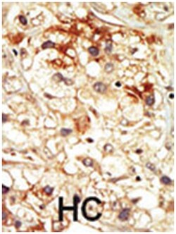 PCTK2, Rabbit, Polyclonal Antibody, Abnova 400&mu;L; Unlabeled:Anticuerpos