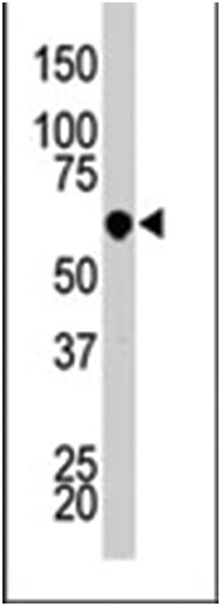PCTK3, Rabbit, Polyclonal Antibody, Abnova 400 &mu;L | Buy Online | Abnova Corporation | Fisher Scientific