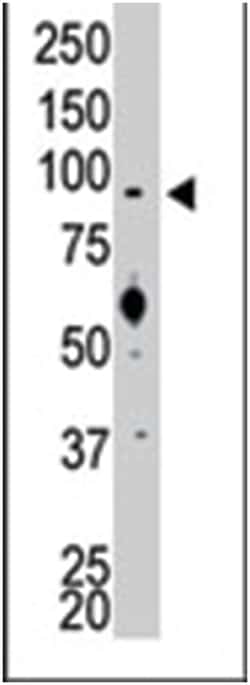 SRPK1 Rabbit anti-Human, Polyclonal Antibody, Abnova 400 &mu;L | Buy Online | Abnova Corporation | Fisher Scientific