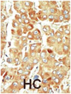 SRPK1 Rabbit anti-Human, Polyclonal Antibody, Abnova 400 &mu;L | Buy Online | Abnova Corporation | Fisher Scientific