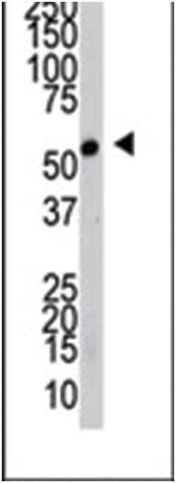 SRPK2, Rabbit, Polyclonal Antibody, Abnova 400 &mu;L | Buy Online | Abnova Corporation | Fisher Scientific