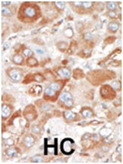 SRPK2, Rabbit, Polyclonal Antibody, Abnova 400 &mu;L | Buy Online | Abnova Corporation | Fisher Scientific