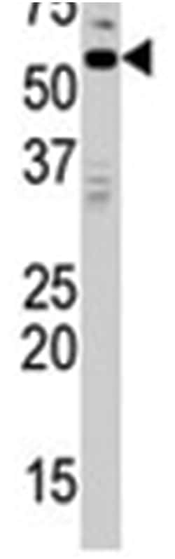 MAPK15 Rabbit anti-Human, Polyclonal Antibody, Abnova 400 &mu;L | Buy Online | Abnova Corporation | Fisher Scientific