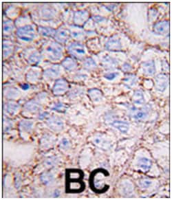 MAPK15 Rabbit anti-Human, Polyclonal Antibody, Abnova 400 &mu;L | Buy Online | Abnova Corporation | Fisher Scientific