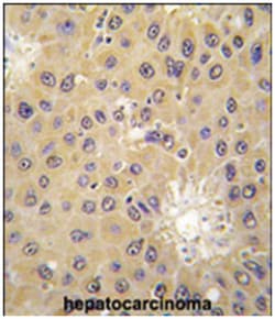 ACAT1 Rabbit anti-Human, Polyclonal Antibody, Abnova 400 &mu;L | Buy Online | Abnova Corporation | Fisher Scientific