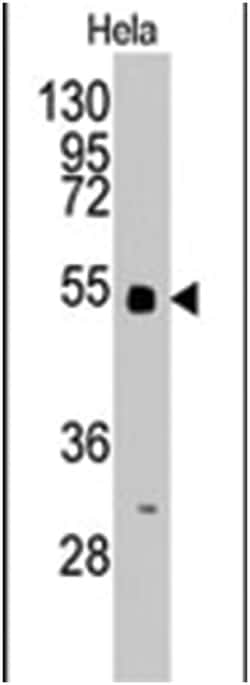 BBS4, Rabbit, Polyclonal Antibody, Abnova 400 &mu;L | Buy Online | Abnova Corporation | Fisher Scientific