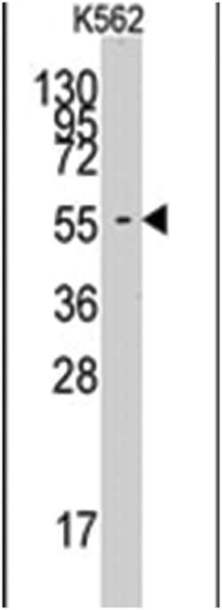 FARSA, Rabbit, Polyclonal Antibody, Abnova 400 &mu;L | Buy Online | Abnova Corporation | Fisher Scientific