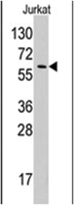 YARS Rabbit anti-Human, Polyclonal Antibody, Abnova 400 &mu;L | Buy Online | Abnova Corporation | Fisher Scientific