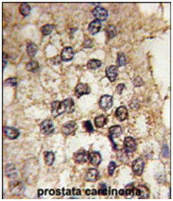 CLOCK, Rabbit, Polyclonal Antibody, Abnova 400&mu;L; Unlabeled:Antibodies,