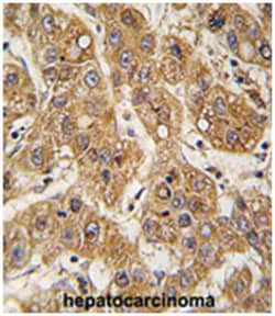 APOE Rabbit anti-Human, Polyclonal Antibody, Abnova 400 &mu;L | Buy Online | Abnova Corporation | Fisher Scientific