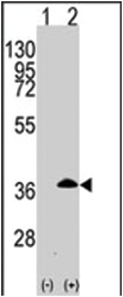 APOE Rabbit anti-Human, Polyclonal Antibody, Abnova 400 &mu;L | Buy Online | Abnova Corporation | Fisher Scientific