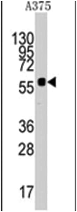 KREMEN1 Rabbit anti-Human, Polyclonal Antibody, Abnova 400 &mu;L | Buy Online | Abnova Corporation | Fisher Scientific