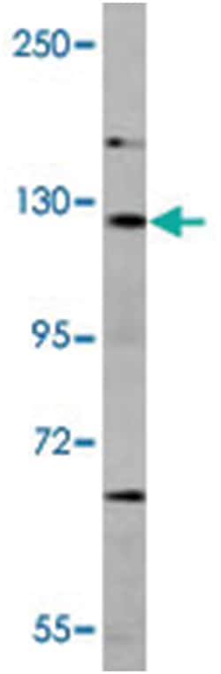 DAAM2, Rabbit, Polyclonal Antibody, Abnova 400 &mu;L | Buy Online | Abnova Corporation | Fisher Scientific