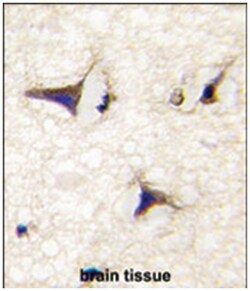 DAAM2, Rabbit, Polyclonal Antibody, Abnova 400 &mu;L | Buy Online | Abnova Corporation | Fisher Scientific