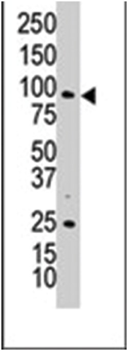 AXL Rabbit anti-Human, Polyclonal Antibody, Abnova 400 &mu;L | Buy Online | Abnova Corporation | Fisher Scientific