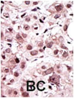 AXL Rabbit anti-Human, Polyclonal Antibody, Abnova 400 &mu;L | Buy Online | Abnova Corporation | Fisher Scientific