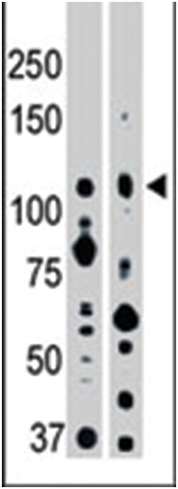EPHA2, Rabbit, Polyclonal Antibody, Abnova 400 &mu;L | Buy Online | Abnova Corporation | Fisher Scientific