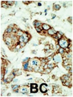 EPHA2, Rabbit, Polyclonal Antibody, Abnova 400 &mu;L | Buy Online | Abnova Corporation | Fisher Scientific