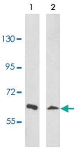 EPHA3 Rabbit anti-Human, Polyclonal Antibody, Abnova 400 &mu;L | Buy Online | Abnova Corporation | Fisher Scientific