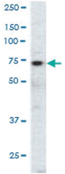 EPHA3 Rabbit anti-Hamster, Human, Polyclonal Antibody, Abnova 400&mu;L;