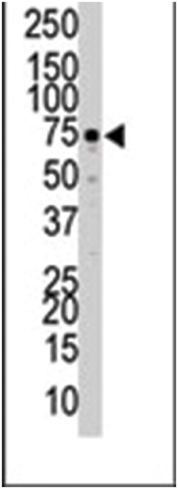 EPHA5 Rabbit anti-Human, Mouse, Polyclonal Antibody, Abnova 400&mu;L; Unlabeled:Antibodies,