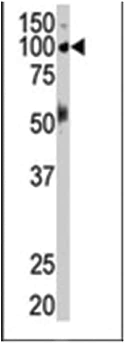EPHB1, Rabbit, Polyclonal Antibody, Abnova 400 &mu;L | Buy Online | Abnova Corporation | Fisher Scientific