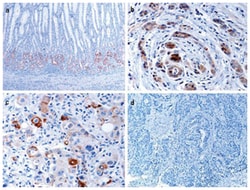 EPHB1, Rabbit, Polyclonal Antibody, Abnova 400 &mu;L | Buy Online | Abnova Corporation | Fisher Scientific
