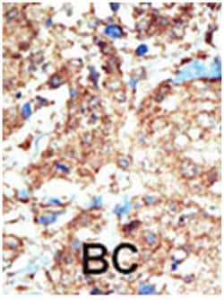 EPHB1, Rabbit, Polyclonal Antibody, Abnova 400 &mu;L | Buy Online | Abnova Corporation | Fisher Scientific