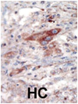 EPHB2 Rabbit anti-Human, Mouse, Polyclonal Antibody, Abnova 400 &mu;L | Buy Online | Abnova Corporation | Fisher Scientific
