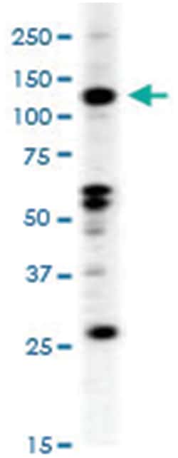EPHB2 Rabbit anti-Human, Polyclonal Antibody, Abnova 400 &mu;L | Buy Online | Abnova Corporation | Fisher Scientific