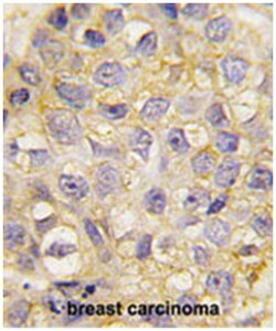 EPHB2 Rabbit anti-Human, Polyclonal Antibody, Abnova 400 &mu;L | Buy Online | Abnova Corporation | Fisher Scientific