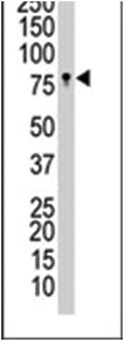 EPHB3, Rabbit, Polyclonal Antibody, Abnova 400 &mu;L | Buy Online | Abnova | Fisher Scientific