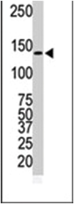 ERBB2 Rabbit anti-Human, Polyclonal Antibody, Abnova 400 &mu;L | Buy Online | Abnova Corporation | Fisher Scientific