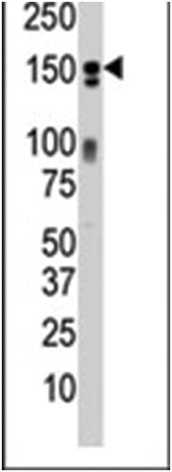ERBB3 Rabbit anti-Human, Mouse, Polyclonal Antibody, Abnova 400&mu;L; Unlabeled:Antibodies,