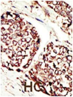 ERBB3 Rabbit anti-Human, Mouse, Polyclonal Antibody, Abnova 400&mu;L; Unlabeled:Antibodies,