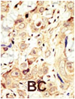 ERBB4 Rabbit anti-Human, Polyclonal Antibody, Abnova 400&mu;L; Unlabeled:Antibodies,