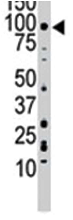 FGFR3 Rabbit anti-Human, Polyclonal Antibody, Abnova 400 &mu;L | Buy Online | Abnova Corporation | Fisher Scientific