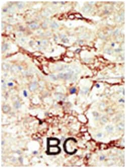 FGFR3 Rabbit anti-Human, Polyclonal Antibody, Abnova 400 &mu;L | Buy Online | Abnova Corporation | Fisher Scientific
