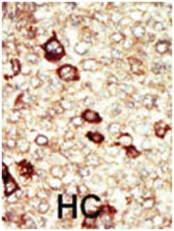 FGFR4, Rabbit, Polyclonal Antibody, Abnova 400 &mu;L | Buy Online | Abnova Corporation | Fisher Scientific